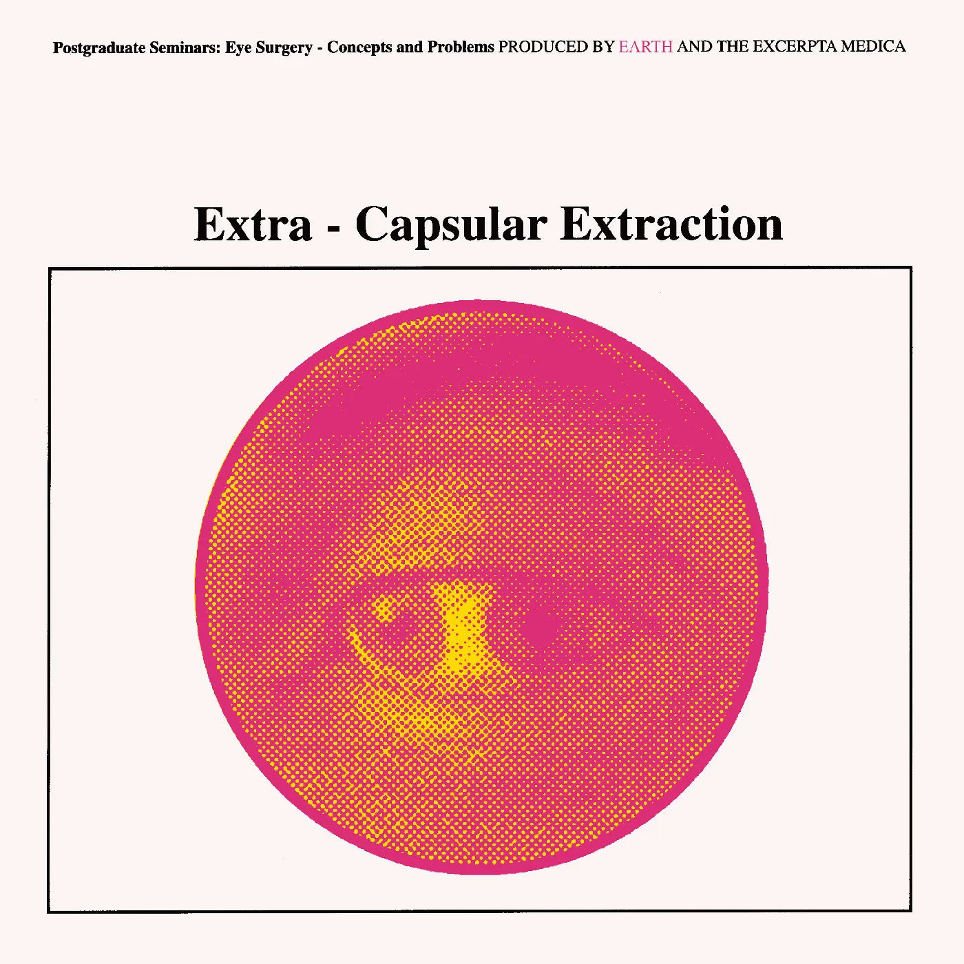 Earth - Extra-Capsular Extraction (Transparent Yellow) Vinyl RSD26